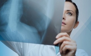 diagnostika cervikální osteochondrózy