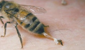 léčba artrózy kyčle včelami